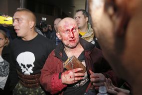 Активист с разбитым лицом