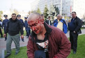 Активист с разбитым лицом