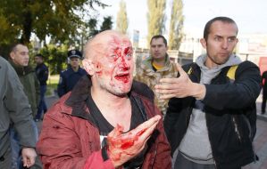 Активист с разбитым лицом