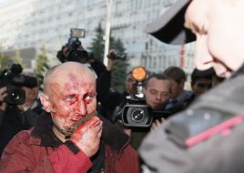 Активист с разбитым лицом