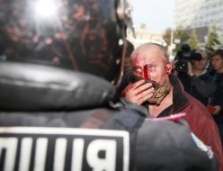 Активист с разбитым лицом