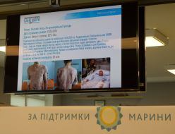 Member of the social project "Bank of the skin. Treatment of Burns"