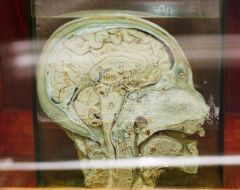 Model of median cut head