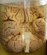 The human brain