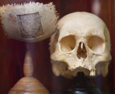 The human skull