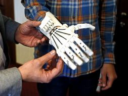 The prosthetic wrist printed on 3D printer