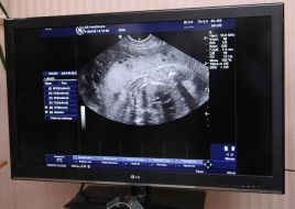 Ultrasound examination