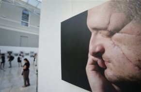 Photo Exhibition "Wounds"