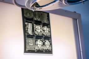 X-rays in the operating room