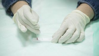 The rapid HIV testing