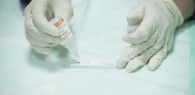 The rapid HIV testing