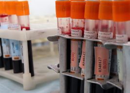 Test tubes with blood