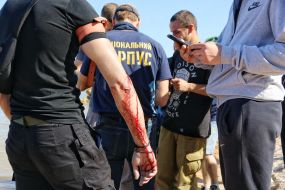 Conflict on the Odessa beach