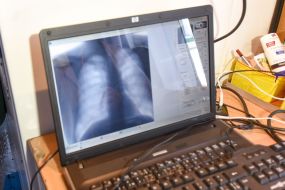 Digital X-ray on a laptop screen