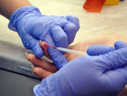 Забор крови из пальца