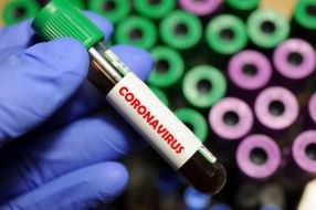 Test tube labeled "Coronavirus"
