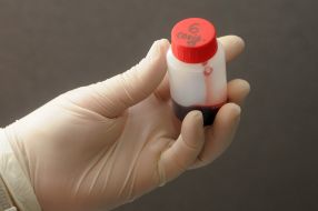 Container with blood