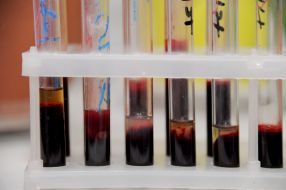 Blood in test tubes