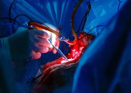 The neurosurgeon removes the brain tumor