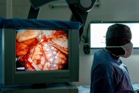 Surgery to remove a brain tumor (surgery to wake the patient)