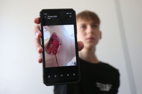 Ігор Белянський, який постраждав внаслідок збройної агресії рф, у лікарні