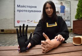 A woman presents hand prostheses