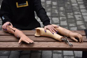 A woman presents hand prostheses
