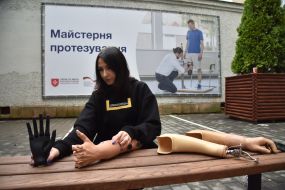 A woman presents hand prostheses