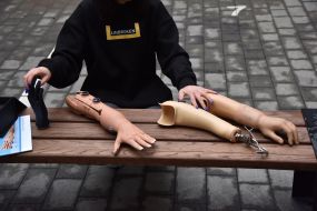A woman presents hand prostheses