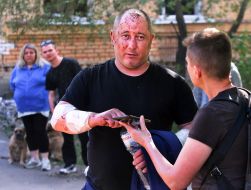 A man injured after a massive Russian attack on Kyiv