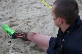 Participant of the "Wild Race Autumn 2025" with a knee injury