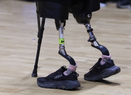 A competitor with prosthetics