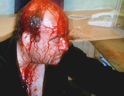 Закривавлені потерпілі після нападу на офіс Вітренко (фото)