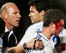 У матчі ”Челсі” - ”Вайкомб” пролилася кров (фото)