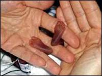 Врачи спасли новорожденного ребенка весом 284 грамма (фото)