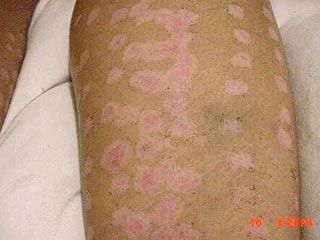 Кадр телеканалу АБС