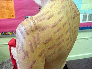 Кадр телеканалу АБС