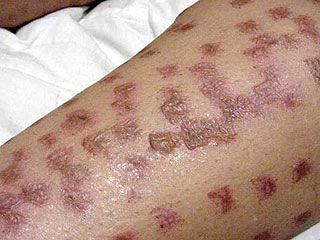 Кадр телеканалу АБС