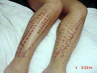 Кадр телеканалу АБС