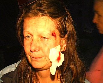 Киевляне опять устраивают побоища из-за застроек (фоторепортаж)