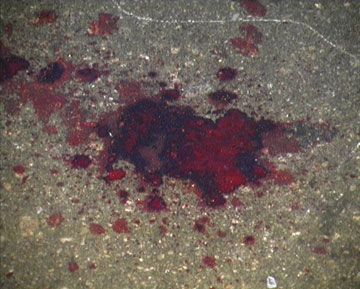 Киевляне опять устраивают побоища из-за застроек (фоторепортаж)