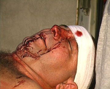 Киевляне опять устраивают побоища из-за застроек (фоторепортаж)