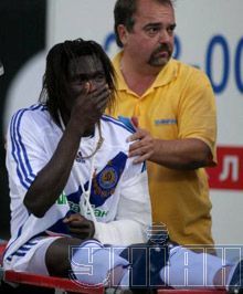 Центральный защитник Динамо получил серьезную травму (фото)