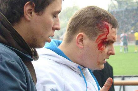 Побоїще на матчі Нафтовик - Динамо: хто винен? (фоторепортаж)