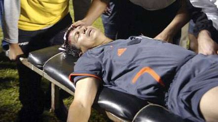 Футбольному арбитру разбили голову камнем (добавлены фото)