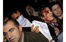 В Тбилиси произошли столкновения оппозиции с полицией: есть пострадавшие