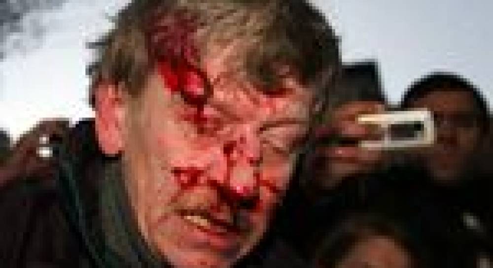 Як оновлений ніс вернувся до Леніна на Бессарабку