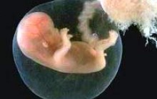 Львівські депутати закликають внести заборону абортів до Конституції