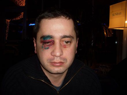 У Донецьку побили продюсера грузинської телекомпанії «Імеді» (фото)