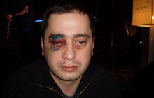 У Донецьку побили продюсера грузинської телекомпанії «Імеді» (фото)
